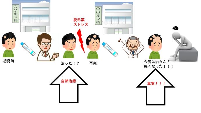 円形脱毛症　病院